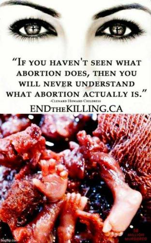 If you don't know what abortion is