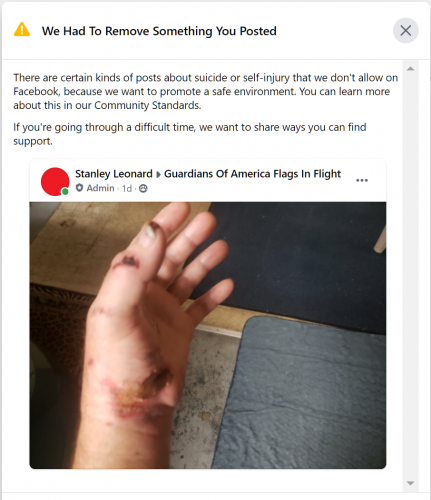 Facebook - We Had To Remove Something You Posted