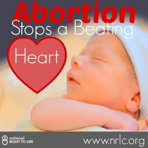 B88686FB-7D91-469E-B941-6B1FBD7EA762