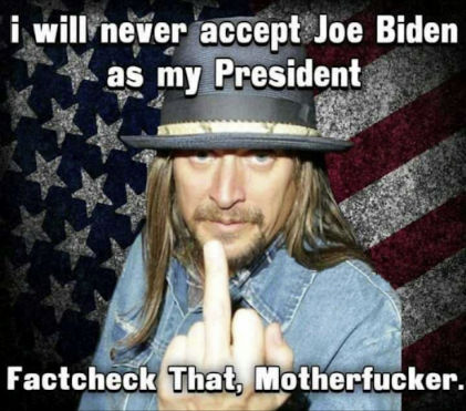 kid rock00