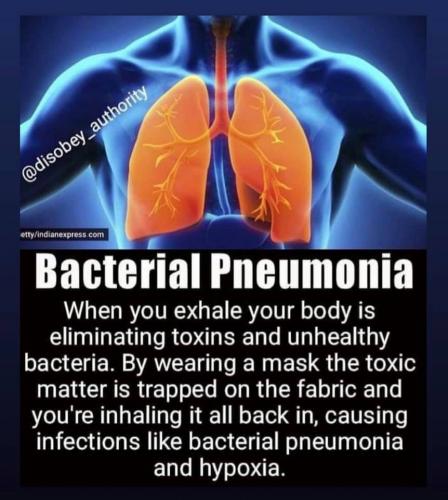 Bacterial Pneumonia
