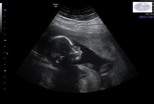 19:40:22 GMT-0500 (EST)