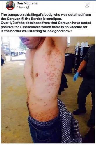 14:32:35 GMT-0600 (CST)