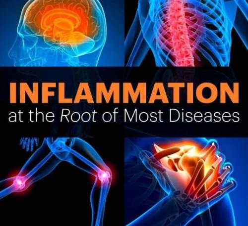 Inflammation-The_Root_Of_Most_Diseases