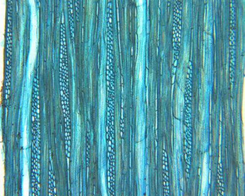 Maytenus micrantha, tangential view