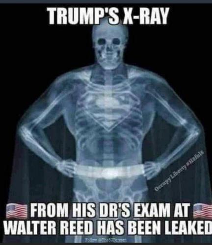 trump superman x ray (1)