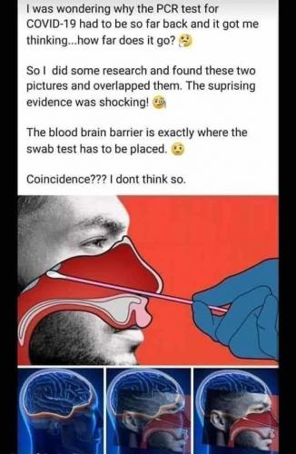 !   Covid 19 test breaks blood brain barrier