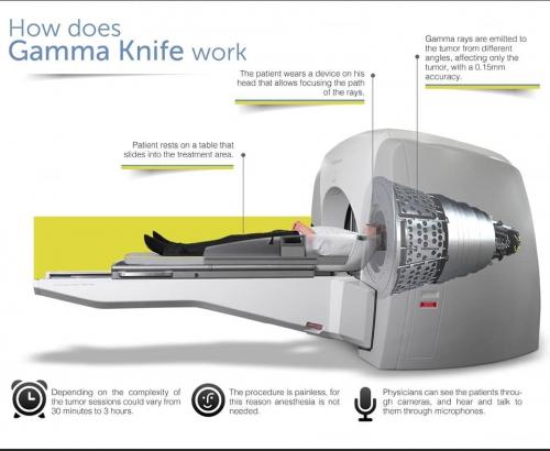 radiosurgery2