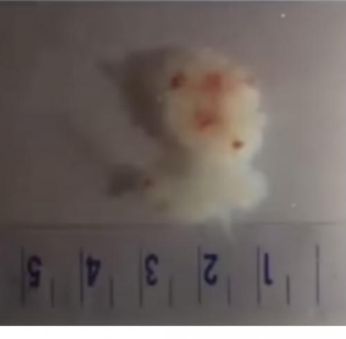 AC5A5DE1-036B-4C37-A265-A46D3E1825EC