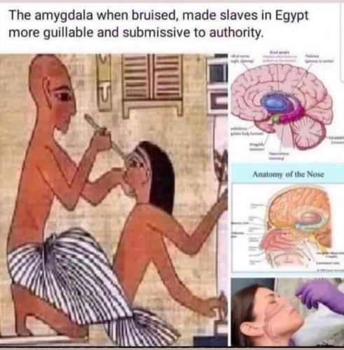 nasal swab covid test intentional damage bruise amygdala gullibility brainwash control