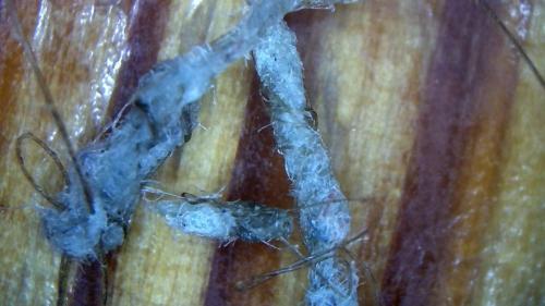 Solar Plexus Cable Network Fiber Balls  (2)