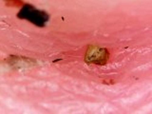 areola wrap opening wpaint