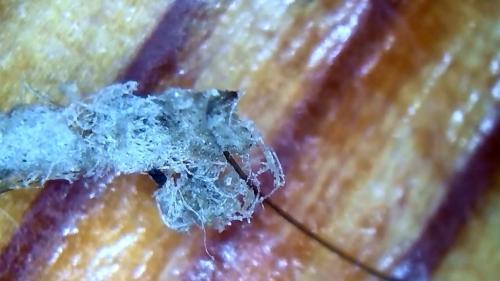 Toe Banding Fiber Ball (7)