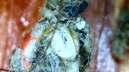 Toe Banding Fiber Ball (2)