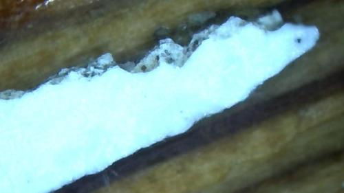 Foot Arch Banding Rod (25)