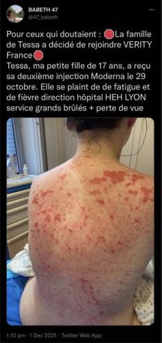 img - 2021-12-02T121849.852