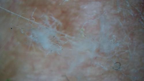 Fiber Optic Cables Surfacing (14)