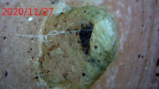 Callus Nano Repair (4)_0_0_320_180_0_0_1_0