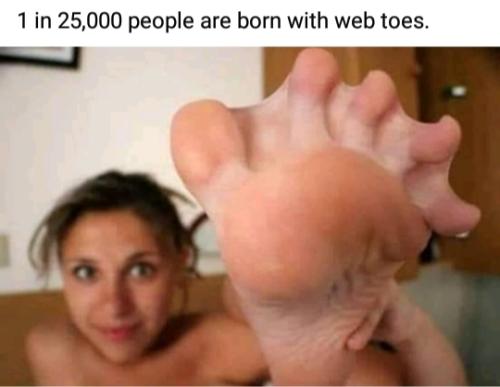 1in25kWebbedFeet