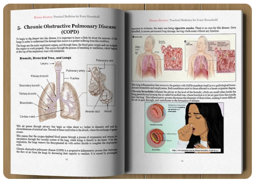 A Simple “At-Home” Protocol for the Flu and Other Respiratory Issues