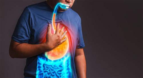 Did you know that acid reflux can become ​ cancerous?