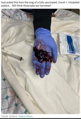 Resized_Screenshot_20220213-100709_MeWe