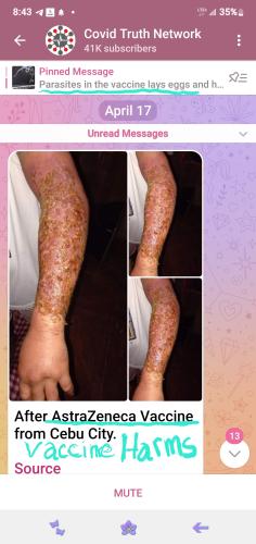 AstraZeneca Vax on Filipino - parasite larvae spread