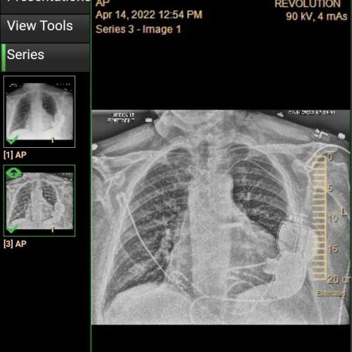 c52d5eb5-04bb-4dd0-b761-34a62b6ccc49