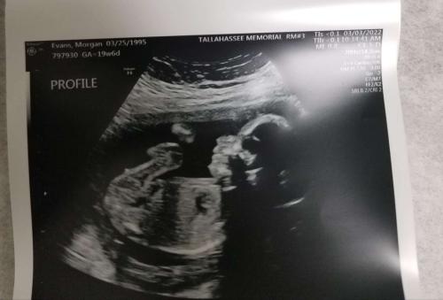 3b50025a-a1ab-4675-9893-d4e06ed40982