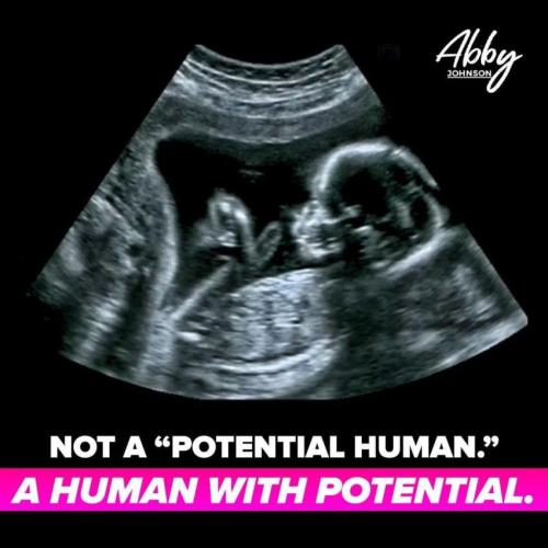 B40F45A4-DF62-490C-8F24-72DCF1D8DD6F