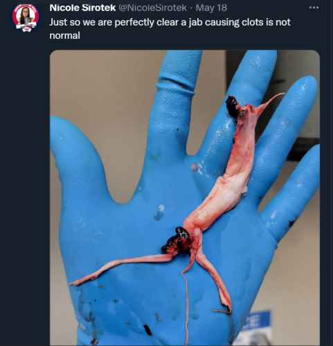 Clots 1