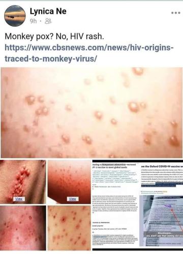 Rash 1