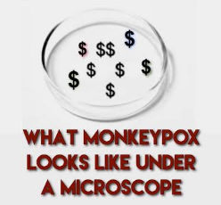 monkeypox12