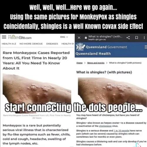 Monkeypox 3