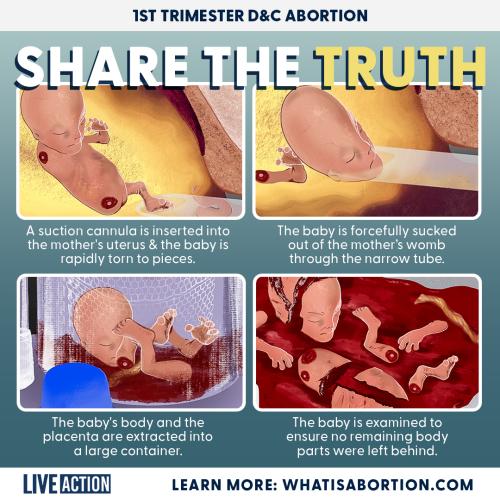 abortion truth f