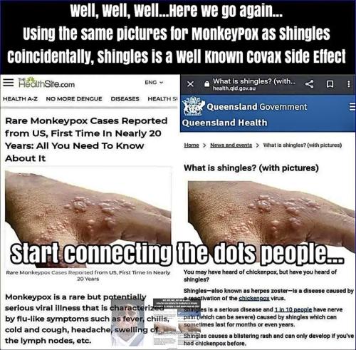 Side effects from jab ie monkey p