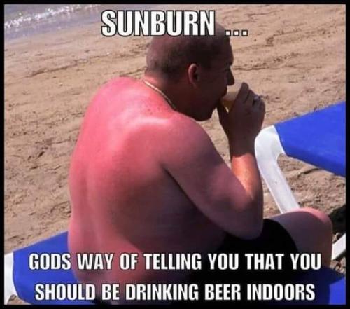 beer sunburn2