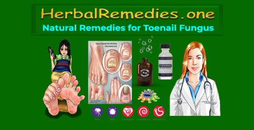 HerbalRemedies..one - Natural Remedies for Toenail Fungus