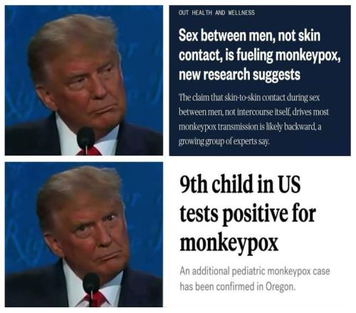 monkeypox43