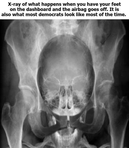 democrat with head up their ass