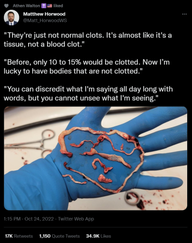 #Strange growth like clots found in nearly all autopsies