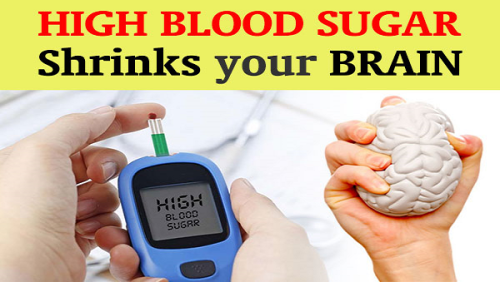 WARNING High Blood Sugar Shrinks Your Brain