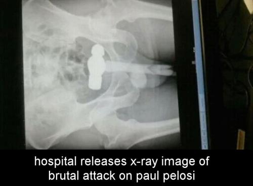 paul pelosi16