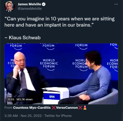 Brain Implants 1