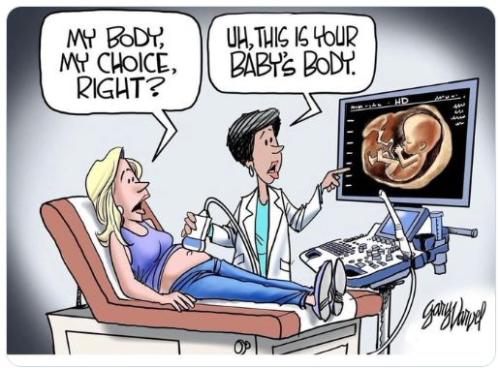 pro life 71