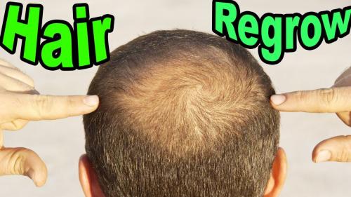 1 Simple Morning Ritual Regrows Your Lost Hair