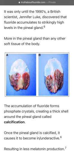 Fluoride and your brain