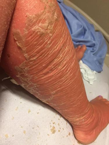 IMG_20230301_211550_401