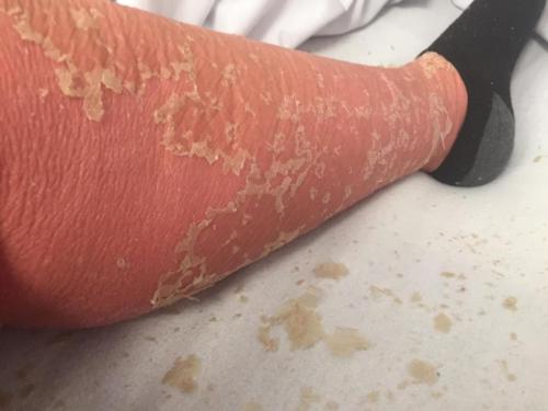 IMG_20230301_211549_739