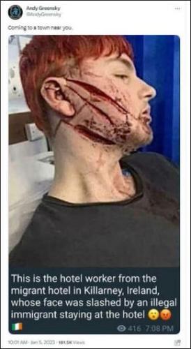 illegal immigration325